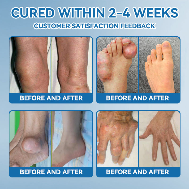 𝖯𝗂𝖼𝗱𝗈® BPC-157 Krem regenerujący stawy 🦴 Skutecznie łagodzi artretyzm, neuropatię, reumatyzm, kontuzje sportowe i wiele więcej 👍👍👍👍