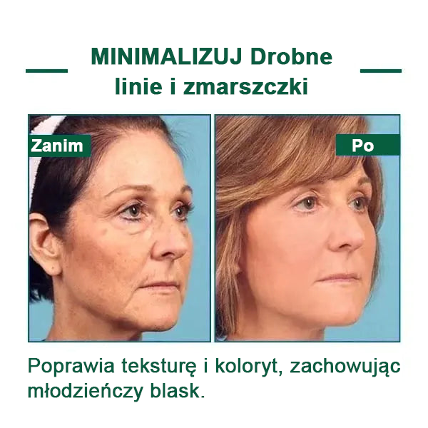 【✨Za pobraniem✨】Wyprzedaż ostatniego dnia 80% taniej - Ujędrniające serum regenerujące Fubsta™🔥