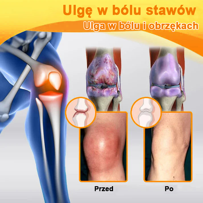 ✅Oficjalny sklep: Ouryard™ Olej magnezowy i miód w sprayu do naprawy stawów👨⚕️Zatwierdzony przez Polską Agencję Leków, Wyrobów Medycznych i Produktów Biologicznych (URPL)🔥🔥