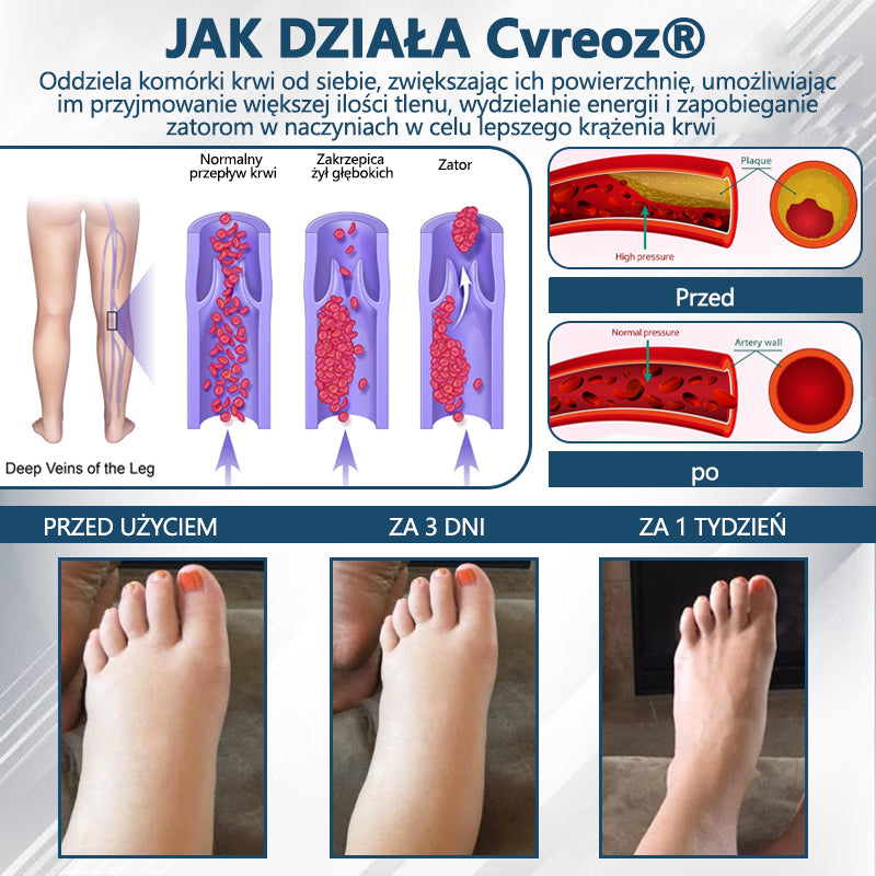 Detoksykujący krem ziołowy z czarnym kminkiem Cvreoz®🩹🩹🩹