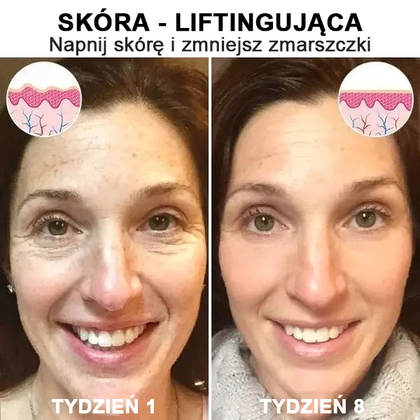 【✨Za pobraniem✨】Wyprzedaż ostatniego dnia 80% taniej - Ujędrniające serum regenerujące Fubsta™🔥