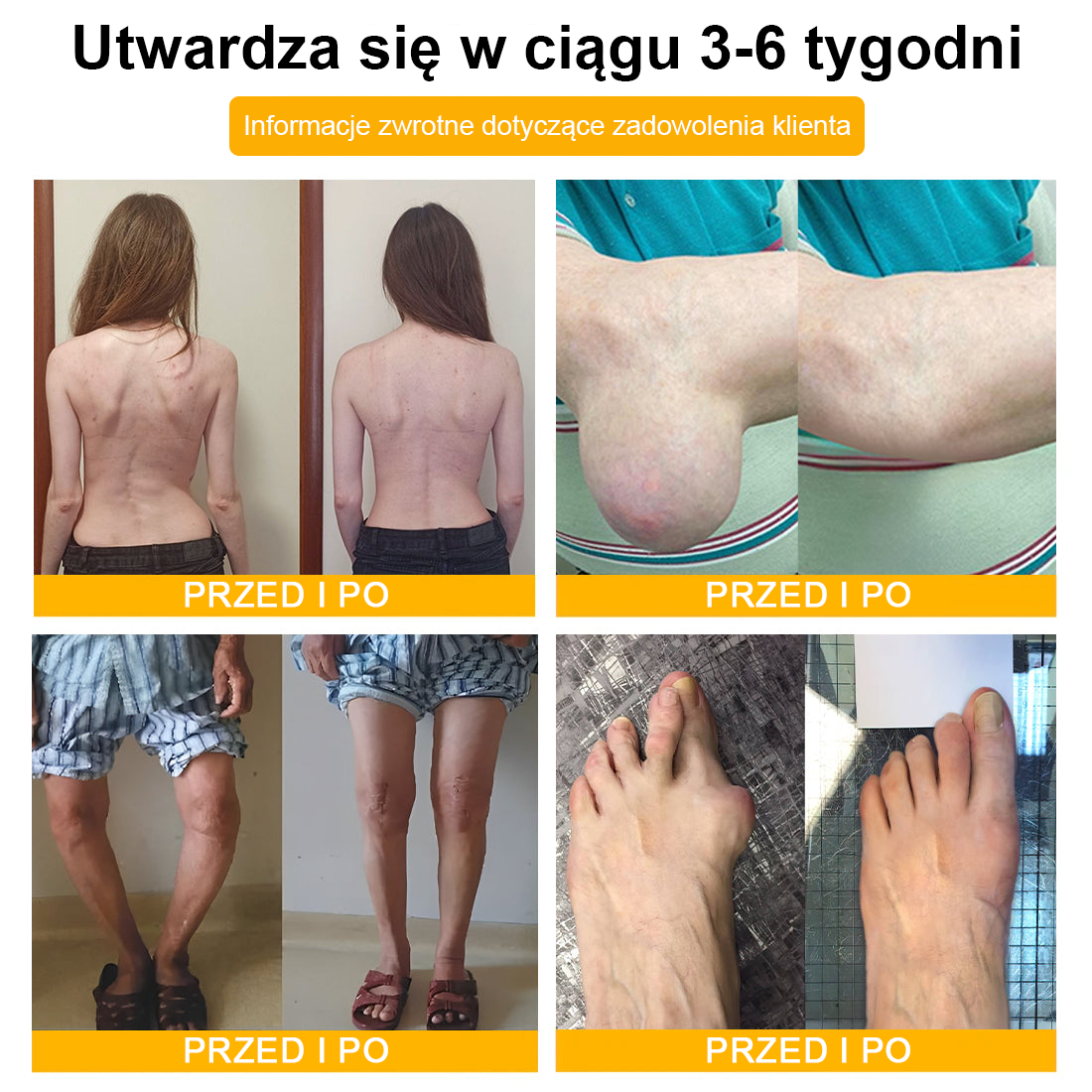 🦴TLOPA® Toksyna botulinowa i jad pszczeli Krem przeciwbólowy do gojenia kości🔥