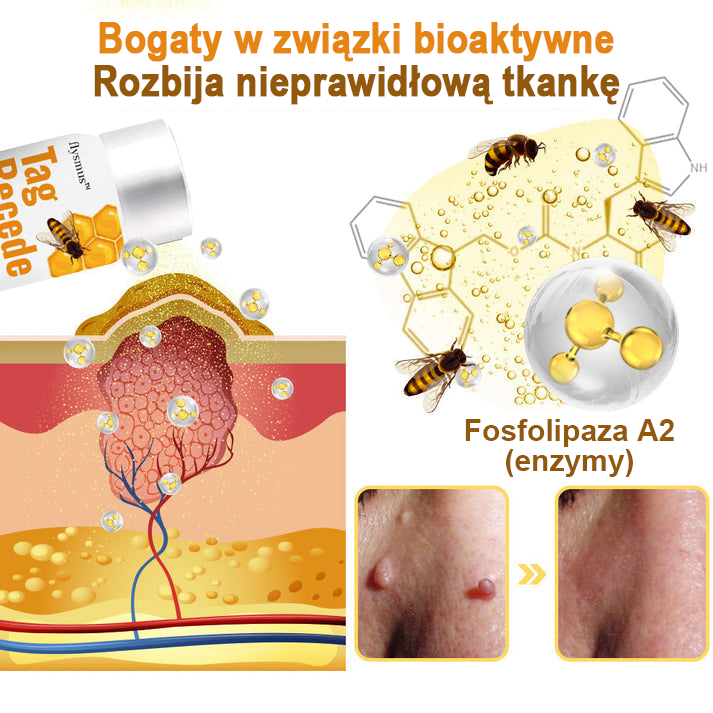 🐝flysmus™ Sprej z jadem pszczelim do usuwania brodawek i znamion skórnych 🐝🐝🐝🐝