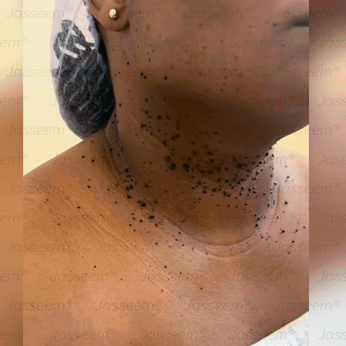 SIE𝖭𝖮𝖵𝖠™ Zaawansowany nieinwazyjny laser CO₂ do naprawy skóry 🎉 (Delikatnie usuwa brodawki, znamiona, plamy starcze i narośla skórne – bez bólu, bez zamieszania!)🔥