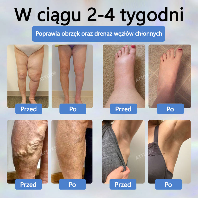 💧💧ATTDX® Krem ziołowy łagodzący obrzęki z czarnuszką💧💧