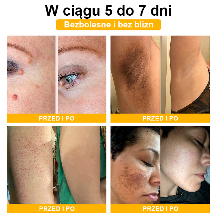 🏵️Turonu™ leczniczy krem do skóry z jadem pszczelim (zalecany przez AAD)🌷🌷