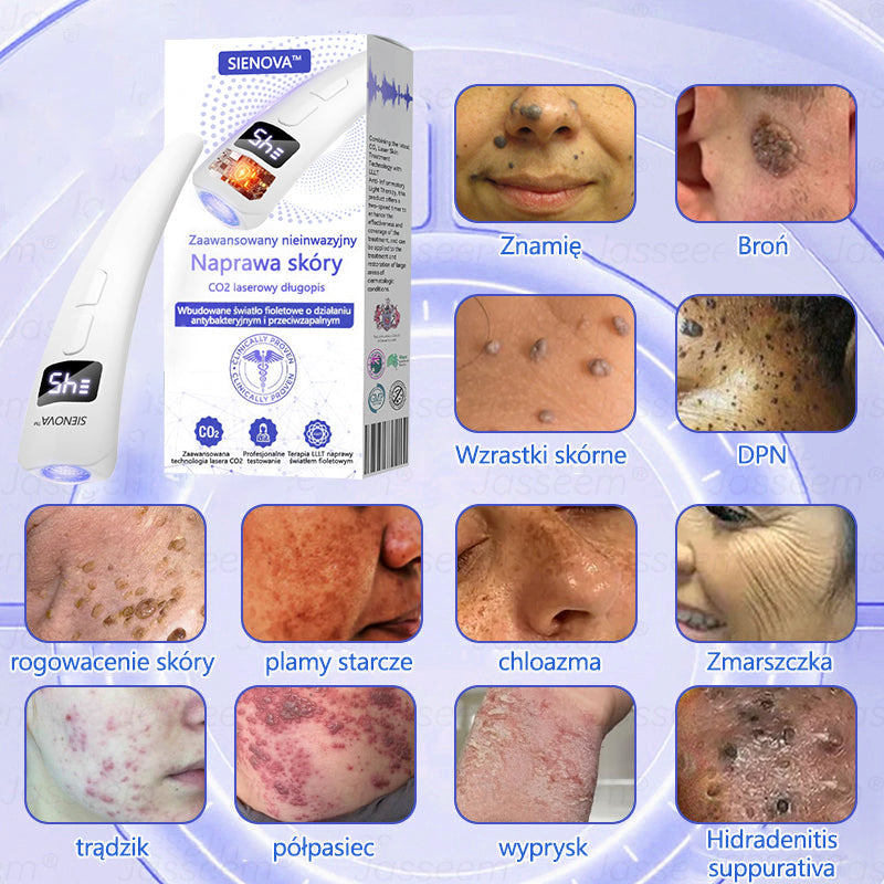 SIE𝖭𝖮𝖵𝖠™ Zaawansowany nieinwazyjny laser CO₂ do naprawy skóry 🎉 (Delikatnie usuwa brodawki, znamiona, plamy starcze i narośla skórne – bez bólu, bez zamieszania!)🔥