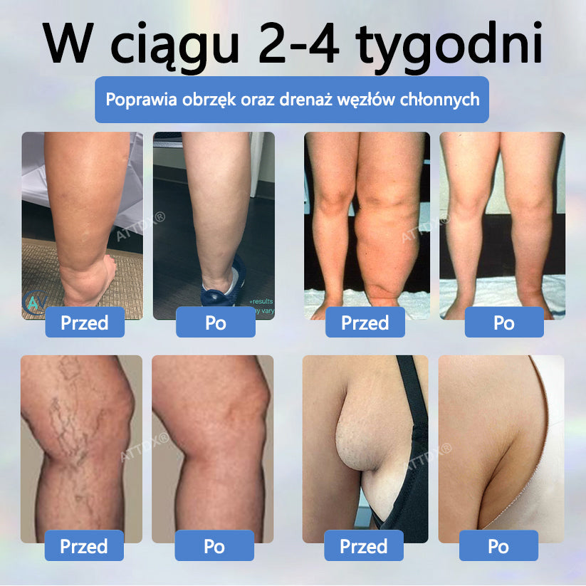 💧💧ATTDX® Krem ziołowy łagodzący obrzęki z czarnuszką💧💧