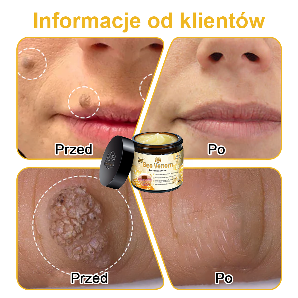 🏵️Turonu™ leczniczy krem do skóry z jadem pszczelim (zalecany przez AAD)🌷🌷