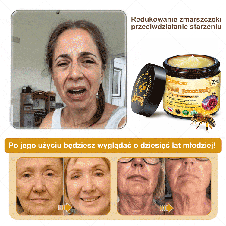 ΑPΚΑPK™ Jad Pszczoły Kompleksowy Krem🥇pomaga w leczeniu problemów skórnych, takich jak: zmarszczki, blizny, plamy pigmentacyjne, rozstępy, trądzik, łuszczyca, egzema, zmiany skórne, podrażnienia, stany zapalne i inne problemy skórne🔥🔥