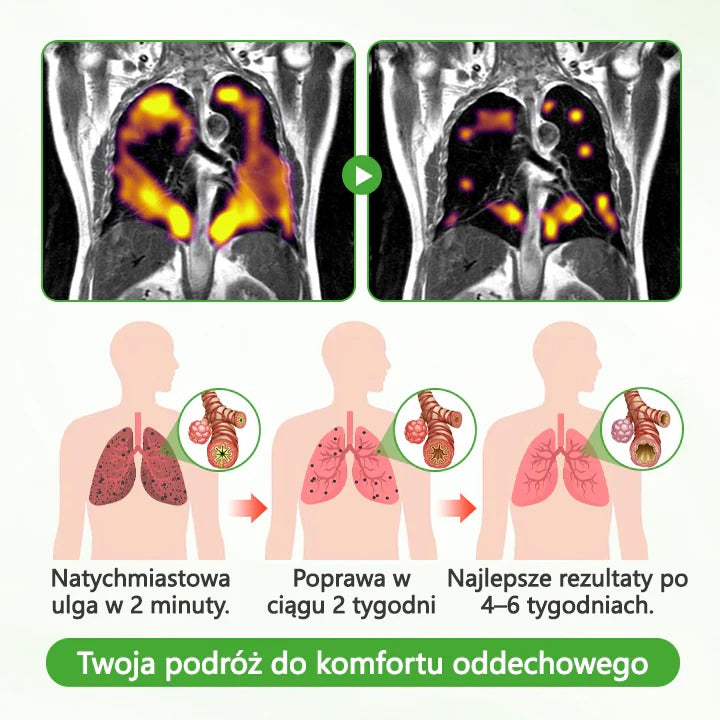 Timilk® HerbaAir Oczyszczacz Płuc z Dziewanny 💖