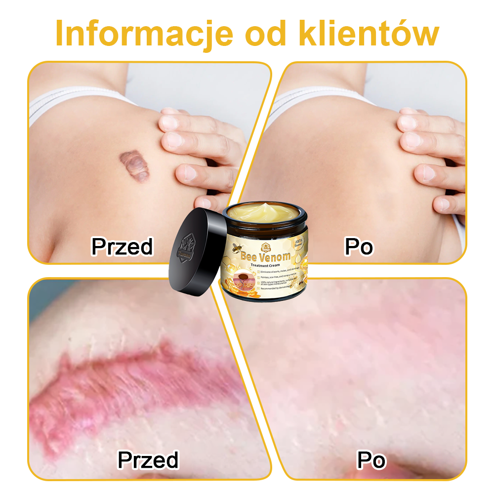 🏵️Turonu™ leczniczy krem do skóry z jadem pszczelim (zalecany przez AAD)🌷🌷