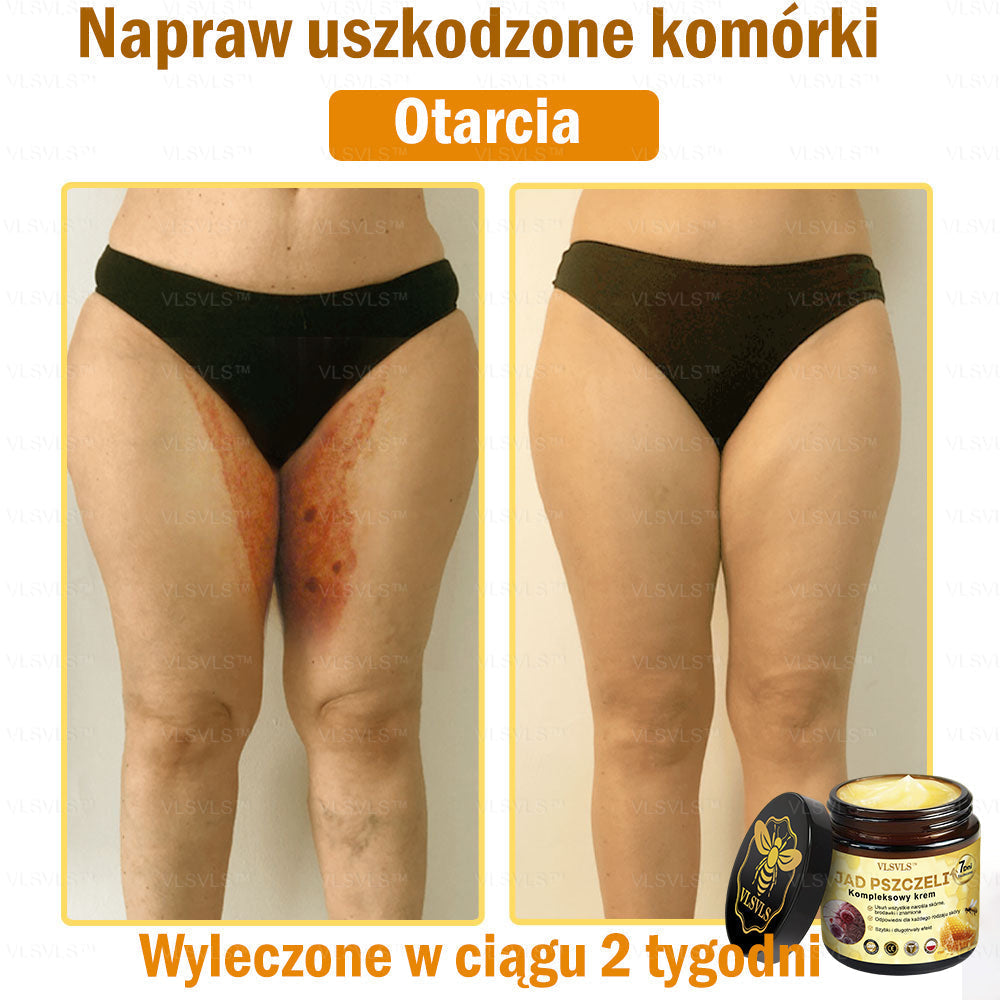 VLSVLS™ Krem Komprehensywny z Jadami Pszczół 🇵🇱 Rekomendowany przez Dermatologów🐝🐝