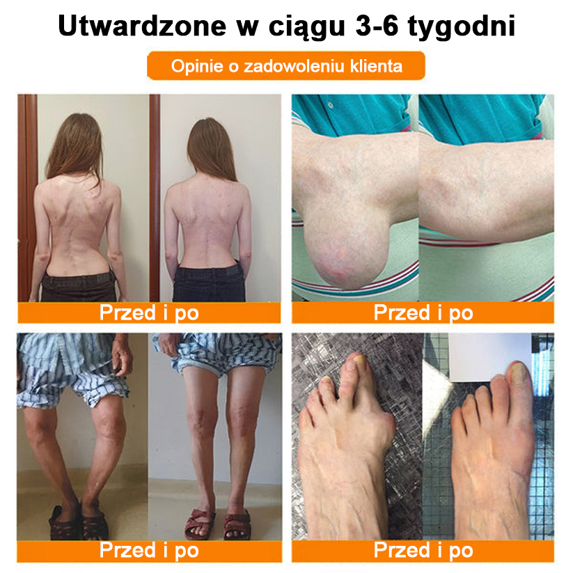 ✅Oficjalny sklep: Ouryard™ Olej magnezowy i miód w sprayu do naprawy stawów👨⚕️Zatwierdzony przez Polską Agencję Leków, Wyrobów Medycznych i Produktów Biologicznych (URPL)🔥🔥