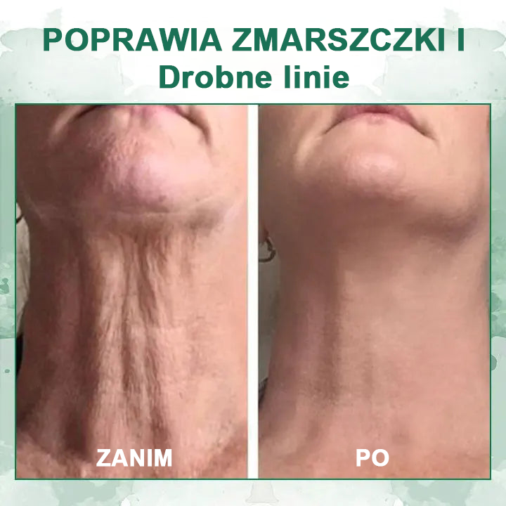 【✨Za pobraniem✨】Wyprzedaż ostatniego dnia 80% taniej - Ujędrniające serum regenerujące Fubsta™🔥