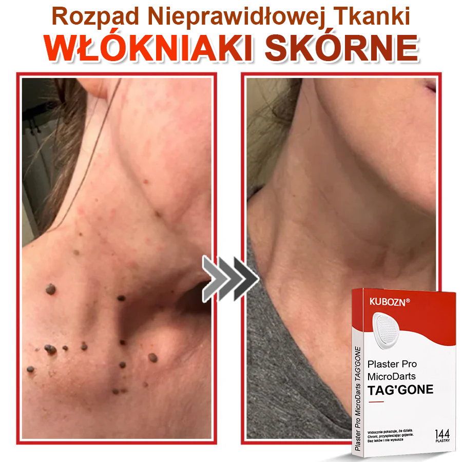 KUBOZN® Mikroigłowy Botaniczny Plaster na Usuwanie Brodawek Skórnych✨✨