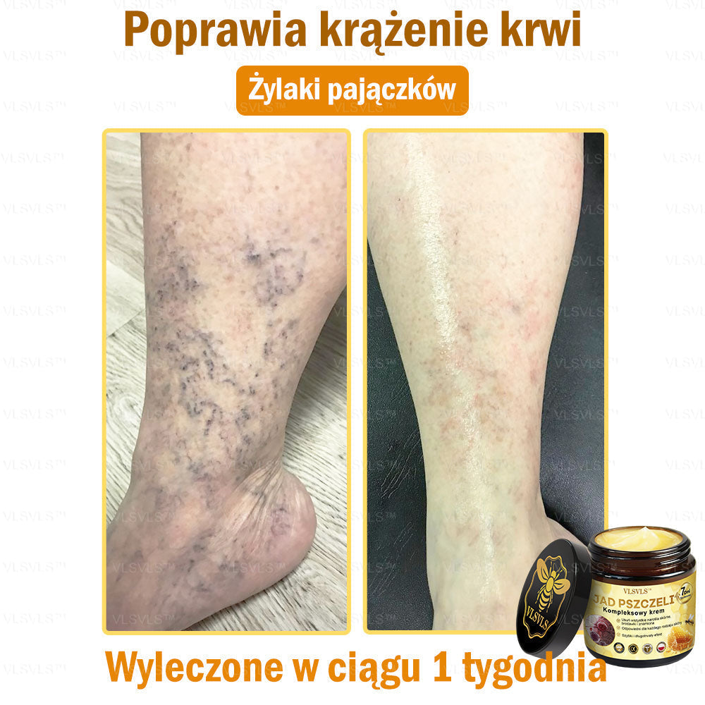 VLSVLS™ Krem Komprehensywny z Jadami Pszczół 🇵🇱 Rekomendowany przez Dermatologów🐝🐝