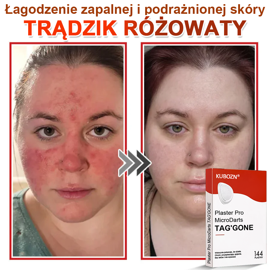 KUBOZN® Mikroigłowy Botaniczny Plaster na Usuwanie Brodawek Skórnych✨✨