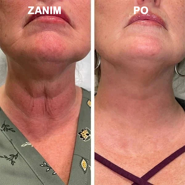 【✨Za pobraniem✨】Wyprzedaż ostatniego dnia 80% taniej - Ujędrniające serum regenerujące Fubsta™🔥