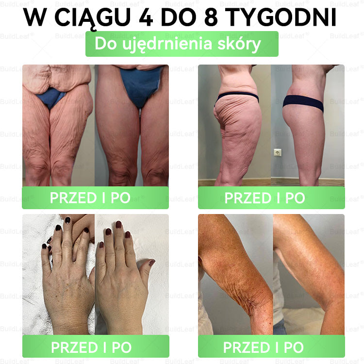 ♻️♻️♻️𝖮𝖋𝗶𝗰𝗷𝗮𝗹𝗻𝘆 𝘀𝗸𝗹𝗲𝗽 | 👩⚕️𝘽𝙪𝙞𝙡𝙙𝙇𝙚𝙖𝙛® 𝗚𝗟𝗣-𝟭 𝟖-w-𝟭 𝗦𝗹𝗶𝗺 & 𝑯𝒆𝒂𝒍𝒕𝐡𝐲 𝑶𝒓𝒂𝒍 𝑺𝒐𝒍𝒖𝒕𝒊𝒐𝒏 (𝑟𝑎𝑧 𝑑𝑧𝑖𝑒𝑛𝑛𝑖𝑒, 𝑟𝑒𝑧𝑢𝑙𝑡𝑎𝑡𝑦 𝑤 7 𝑑𝑛𝑖),Wspiera odchudzanie, serce, cukrzycę, sen, jelita, stawy, a także ujędrnia skórę i dodaje energii✅