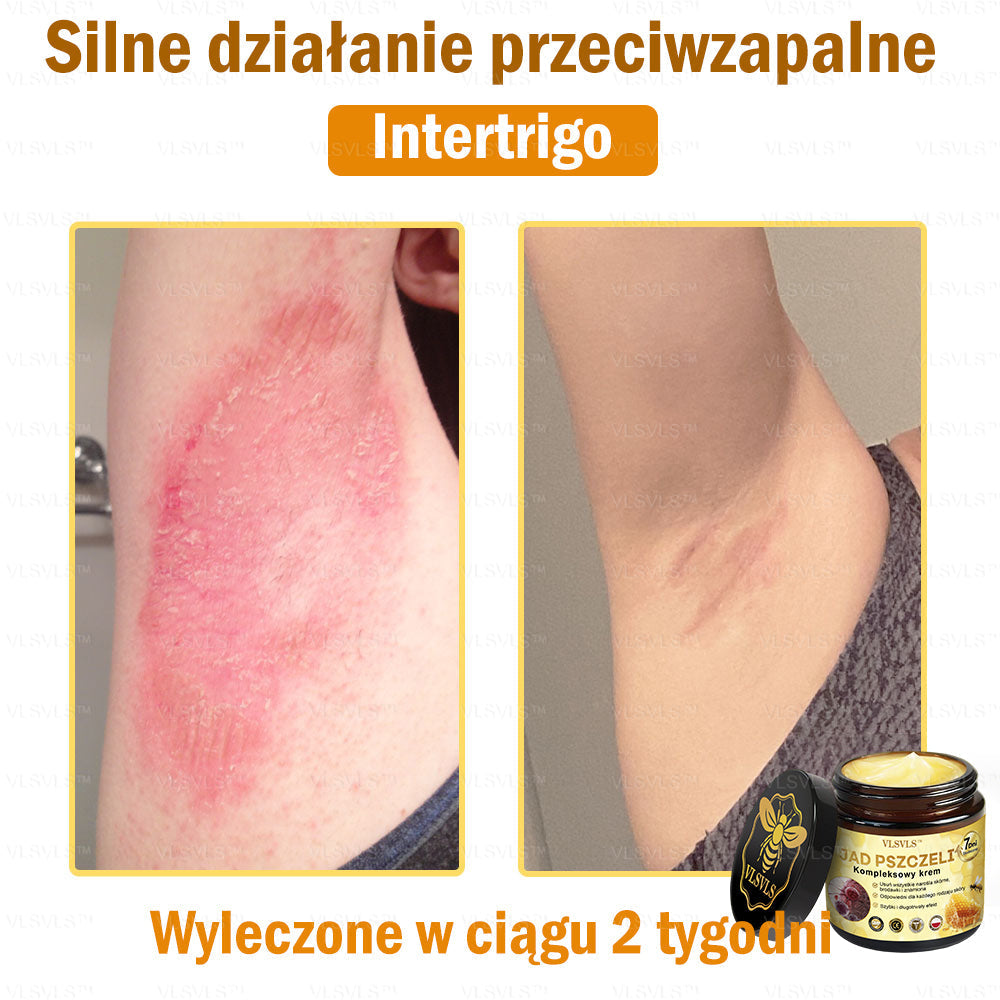 VLSVLS™ Krem Komprehensywny z Jadami Pszczół 🇵🇱 Rekomendowany przez Dermatologów🐝🐝