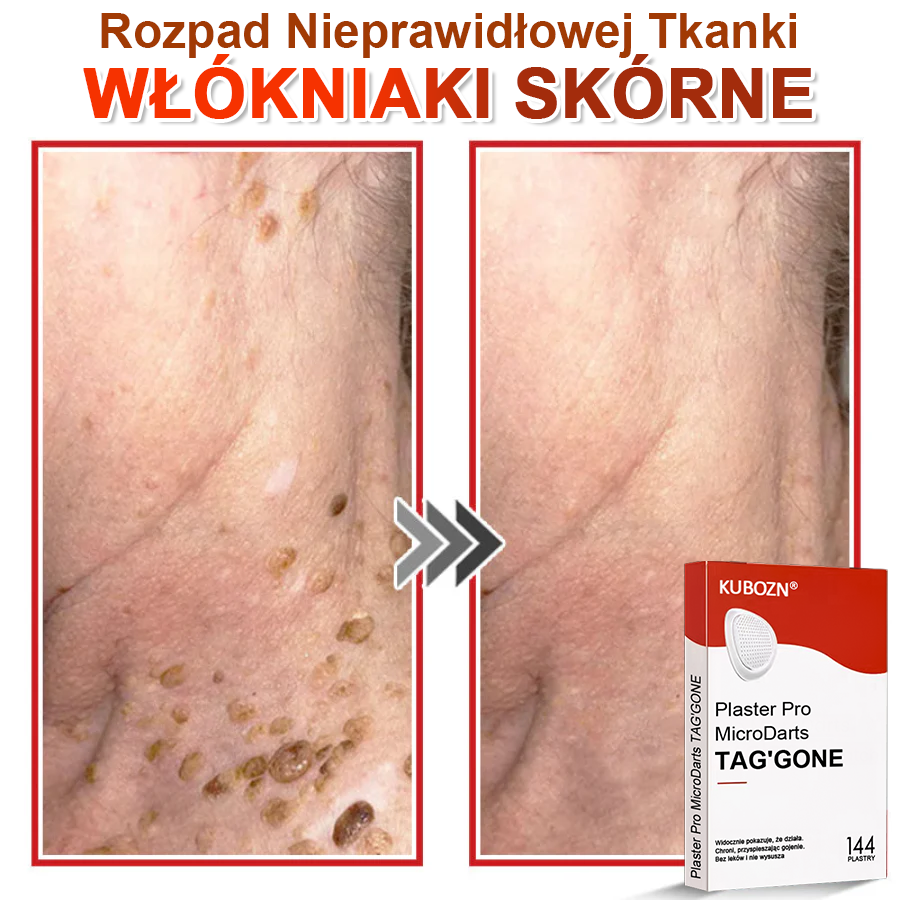 KUBOZN® Mikroigłowy Botaniczny Plaster na Usuwanie Brodawek Skórnych✨✨
