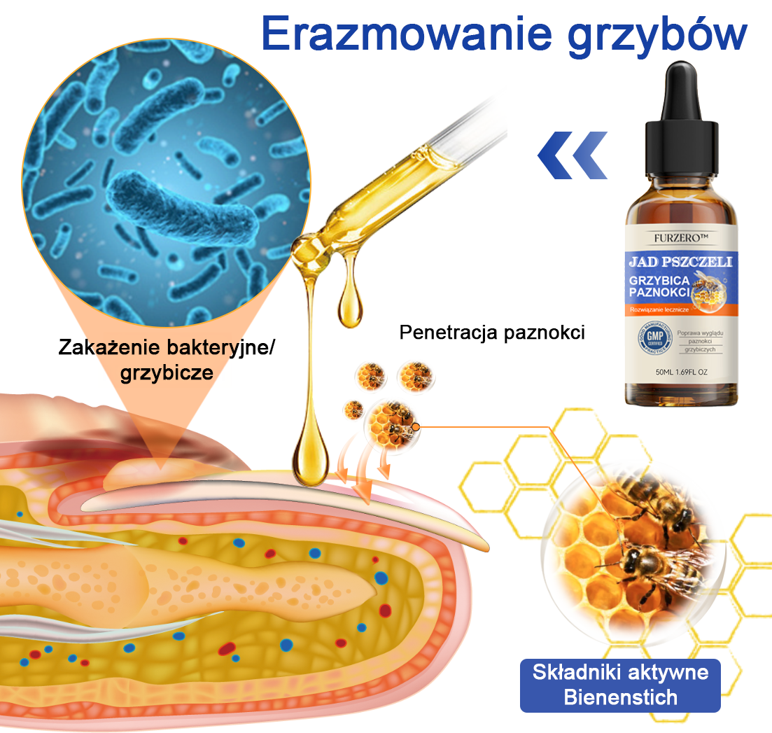 🐝👣Furzero™ Bienengift Nagelpilz Leczenie: Całkowite rozwiązanie problemu grzybicy paznokci🌟👣👣👣👣