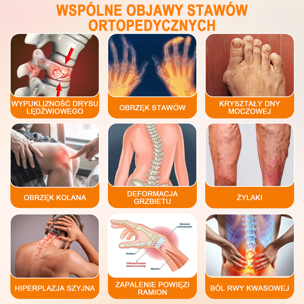 🦴TLOPA® Toksyna botulinowa i jad pszczeli Krem przeciwbólowy do gojenia kości🔥