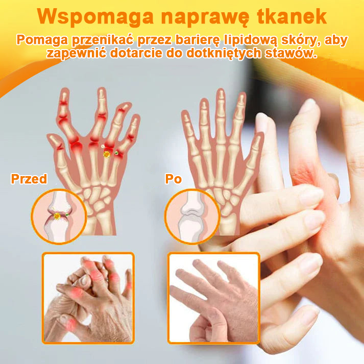 ✅Oficjalny sklep: Ouryard™ Olej magnezowy i miód w sprayu do naprawy stawów👨⚕️Zatwierdzony przez Polską Agencję Leków, Wyrobów Medycznych i Produktów Biologicznych (URPL)🔥🔥