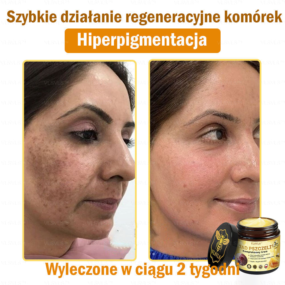 VLSVLS™ Krem Komprehensywny z Jadami Pszczół 🇵🇱 Rekomendowany przez Dermatologów🐝🐝