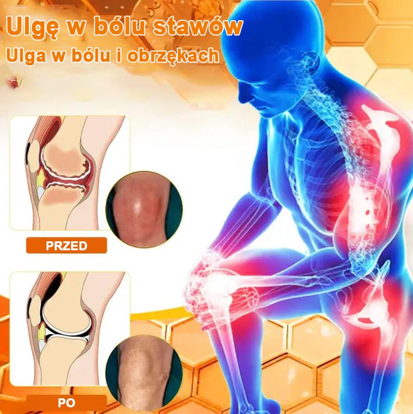 ✅Oficjalny sklep: Ouryard™ Olej magnezowy i miód w sprayu do naprawy stawów👨⚕️Zatwierdzony przez Polską Agencję Leków, Wyrobów Medycznych i Produktów Biologicznych (URPL)🔥🔥