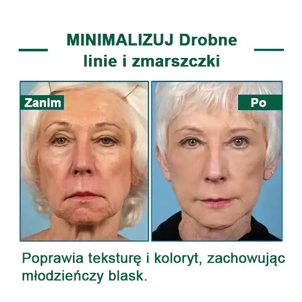 【✨Za pobraniem✨】Wyprzedaż ostatniego dnia 80% taniej - Ujędrniające serum regenerujące Fubsta™🔥