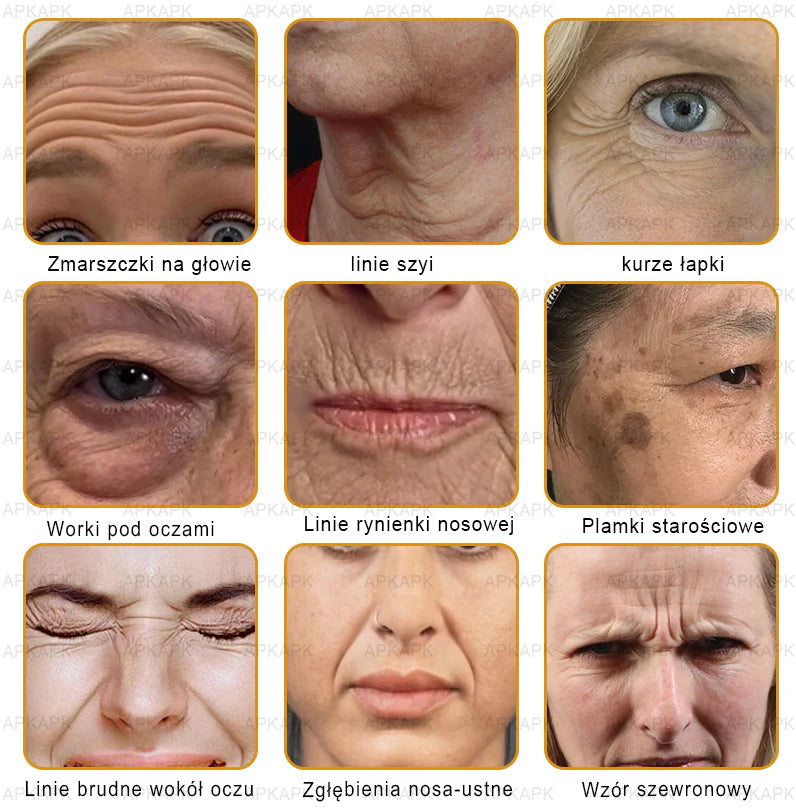 ΑPΚΑPK™ Jad Pszczoły Kompleksowy Krem🥇pomaga w leczeniu problemów skórnych, takich jak: zmarszczki, blizny, plamy pigmentacyjne, rozstępy, trądzik, łuszczyca, egzema, zmiany skórne, podrażnienia, stany zapalne i inne problemy skórne🔥🔥