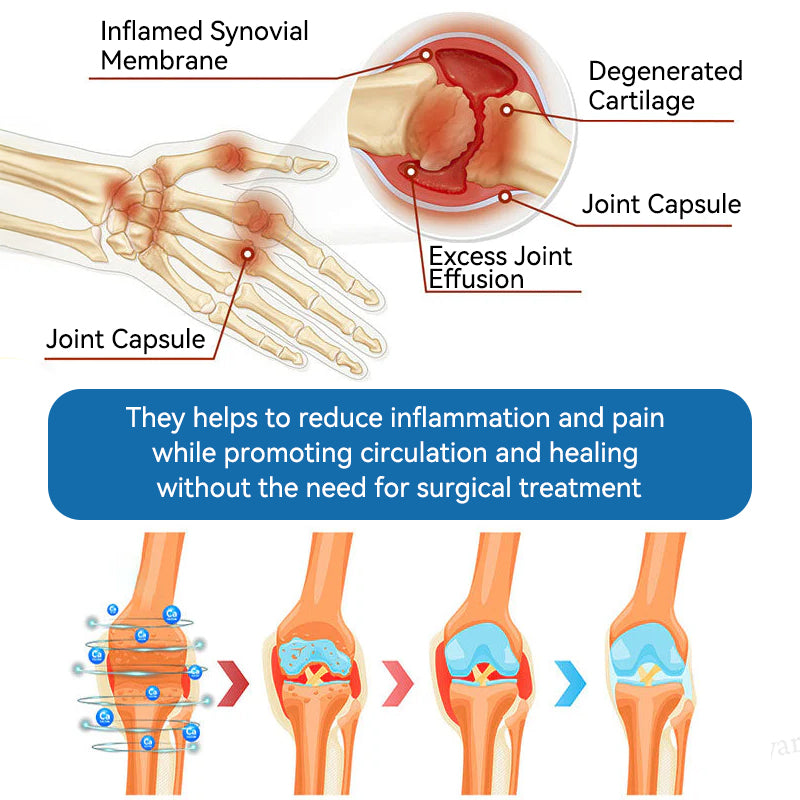 𝖯𝗂𝖼𝗱𝗈® BPC-157 Krem regenerujący stawy 🦴 Skutecznie łagodzi artretyzm, neuropatię, reumatyzm, kontuzje sportowe i wiele więcej 👍👍👍👍