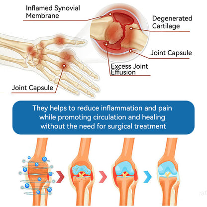𝖯𝗂𝖼𝗱𝗈® BPC-157 Krem regenerujący stawy 🦴 Skutecznie łagodzi artretyzm, neuropatię, reumatyzm, kontuzje sportowe i wiele więcej 👍👍👍
