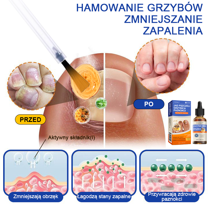 🐝👣Furzero™ Bienengift Nagelpilz Leczenie: Całkowite rozwiązanie problemu grzybicy paznokci🌟👣👣👣👣