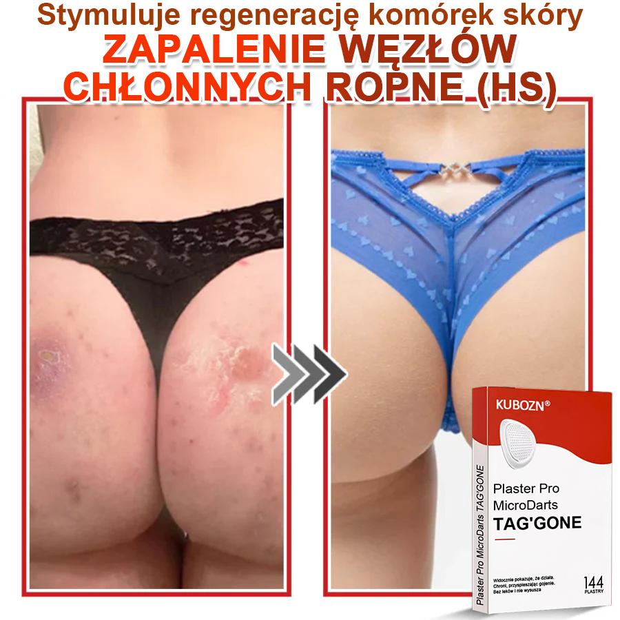 KUBOZN® Mikroigłowy Botaniczny Plaster na Usuwanie Brodawek Skórnych✨✨