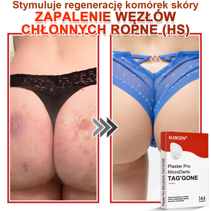 KUBOZN® Mikroigłowy Botaniczny Plaster na Usuwanie Brodawek Skórnych✨✨