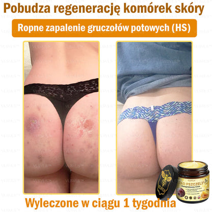 VLSVLS™ Krem Komprehensywny z Jadami Pszczół 🇵🇱 Rekomendowany przez Dermatologów🐝🐝🐝🐝