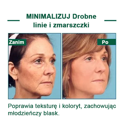 【✨Za pobraniem✨】Wyprzedaż ostatniego dnia 80% taniej - Ujędrniające serum regenerujące Fubsta™🔥🔥🔥