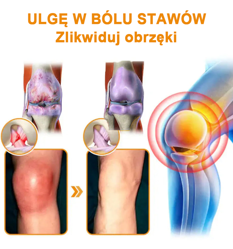 ✅Oficjalny sklep: Ouryard™ Olej magnezowy i miód w sprayu do naprawy stawów👨‍⚕️Zatwierdzony przez Polską Agencję Leków, Wyrobów Medycznych i Produktów Biologicznych (URPL)🔥🔥