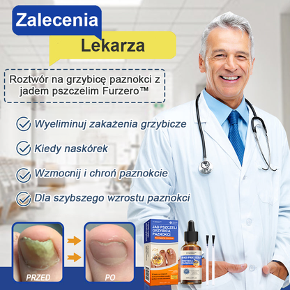 🐝👣Furzero™ Bienengift Nagelpilz Leczenie: Całkowite rozwiązanie problemu grzybicy paznokci🌟👣👣👣👣