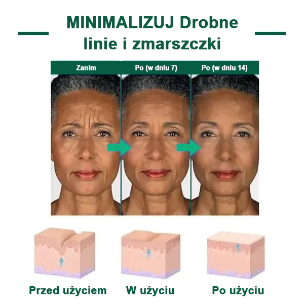 【✨Za pobraniem✨】Wyprzedaż ostatniego dnia 80% taniej - Ujędrniające serum regenerujące Fubsta™🔥🔥🔥