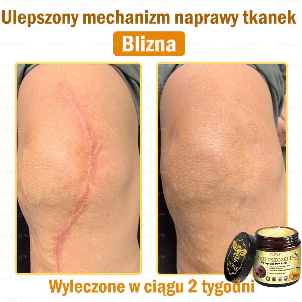 VLSVLS™ Krem Komprehensywny z Jadami Pszczół 🇵🇱 Rekomendowany przez Dermatologów🐝🐝🐝🐝