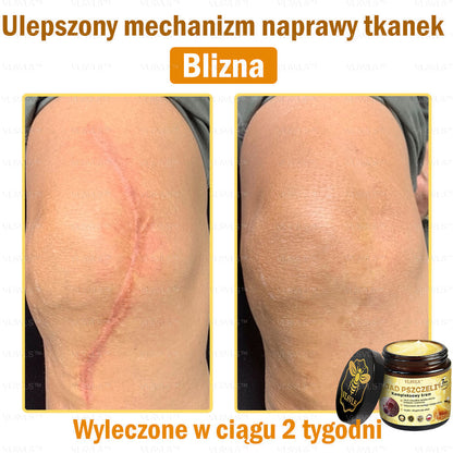 VLSVLS™ Krem Komprehensywny z Jadami Pszczół 🇵🇱 Rekomendowany przez Dermatologów🐝🐝🐝🐝