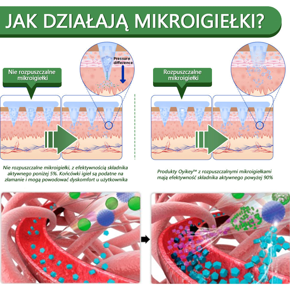 [Zobacz rezultaty po 7 dniach]💐𝗧𝗟𝗢𝗣𝗔® SMGT-GLP-1 Nano Microneedle Patch (bezbolesny, długotrwały, pomagający w leczeniu cukrzycy, otyłości i chorób układu krążenia)💐