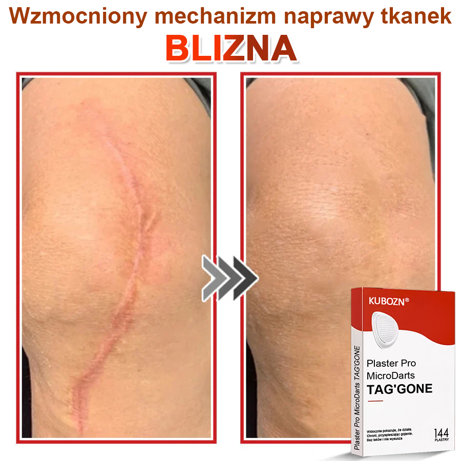 KUBOZN® Mikroigłowy Botaniczny Plaster na Usuwanie Brodawek Skórnych✨✨