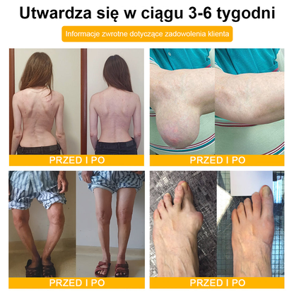 🦴TLOPA® Toksyna botulinowa i jad pszczeli Krem przeciwbólowy do gojenia kości🔥🔥