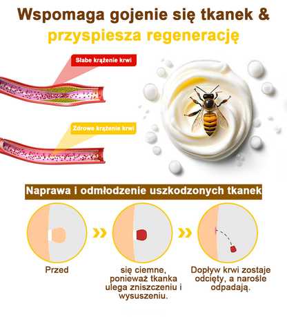 ✅flysmus™ Krem leczniczy z jadem pszczelim🐝: Leczenie egzemy, łuszczycy, trądziku, trądziku różowatego, infekcji grzybiczych, brodawek🐝