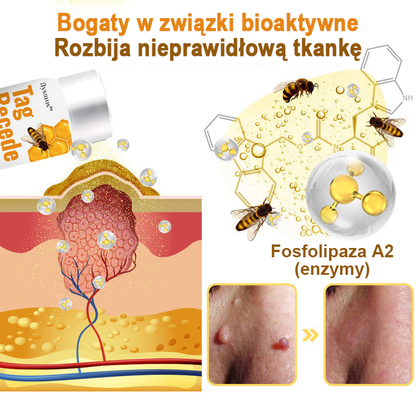 🐝flysmus™ Sprej z jadem pszczelim do usuwania brodawek i znamion skórnych 🐝🐝🐝🐝
